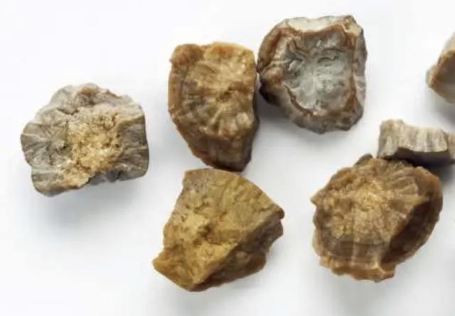 Ladri rubano "pepite" in casa, ma erano calcoli renali appena analizzati: derubato l'ex vicedirettore del Messaggero Veneto, Giuseppe Ragogna