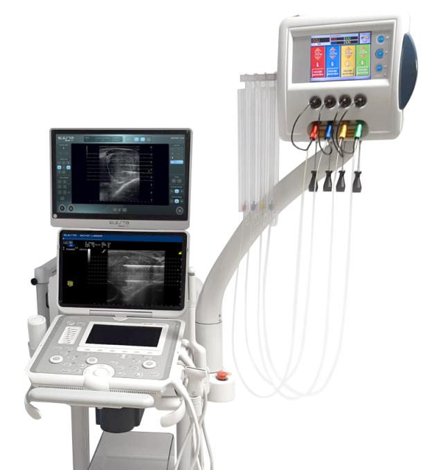 Korian presenta Echolaser, la tecnologia laser-ultrasuoni per il trattamento in day hospital delle patologie prostatiche e tiroidee