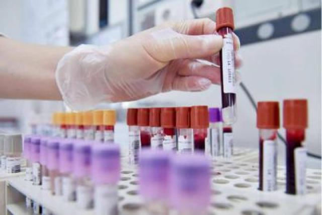 Livorno, boom di leucemie e mielomi, nel 2024 oltre 500 nuove diagnosi, il dottor Capochiani: "Aumento notevole e preoccupante dal 2020"