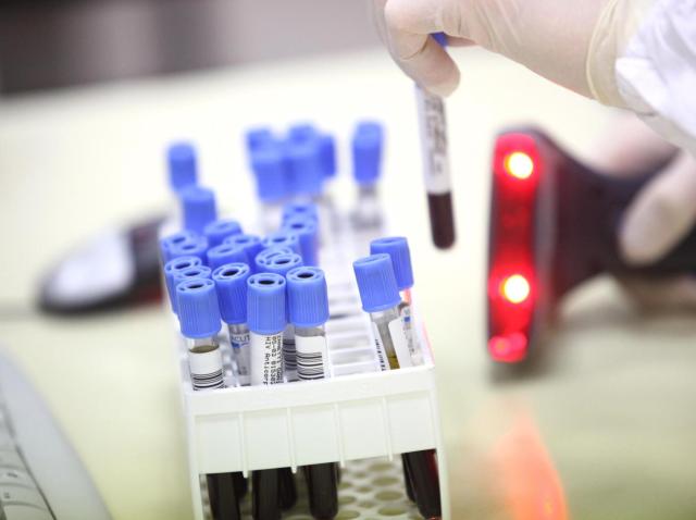 Covid, oggi 71.075 nuovi casi e 155 morti. Tasso positivit&agrave; al 20,8%