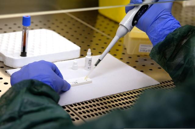 Coronavirus vaccino, Fauci: 'A dicembre possibili prime dosi negli Usa'