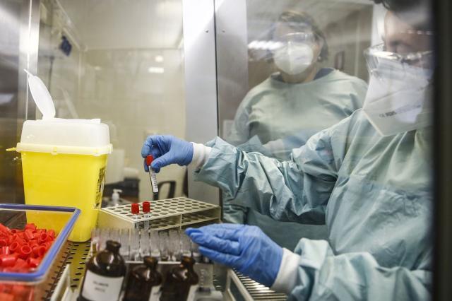 Coronavirus, Ascierto: 'Vaccino entro l'estate, iniziata fase 1 sui pazienti'